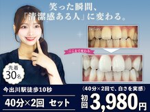 ホワイトニングショップ 今出川店(WHITENING SHOP)