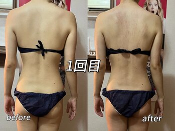 メイ 葛西(Mei)/本気痩せ！結果重視痩身ケア