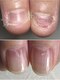 イズム(Izm)の写真/《お悩み爪特化》深爪・丸爪に本気で向き合う美爪育成サロン！