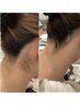 夏に向けて！ネープケア始めませんか？お試しキャンペーン30分5,000円☆★