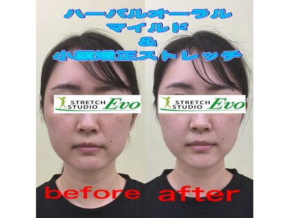 エボの写真