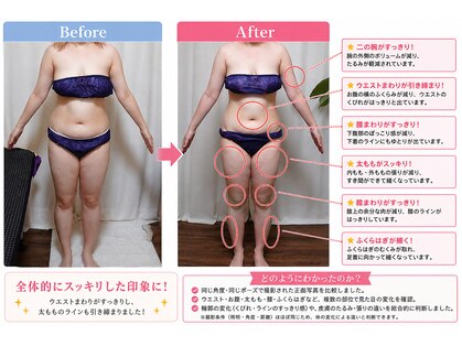 ヨサパーク ヴィオレット(YOSA PARK VIOLET)の写真