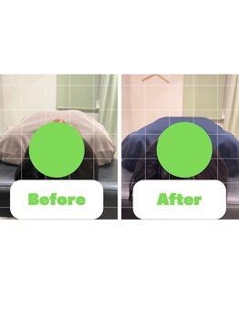 ナオル整体 長崎大村院(NAORU整体)/30代女性施術事例【猫背矯正】