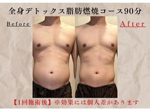 アリッチ 岡崎店(a.Rich)の雰囲気（(岡崎)ダイエットで落ちづらいお腹の脂肪を撃退!理想のボディへ!）