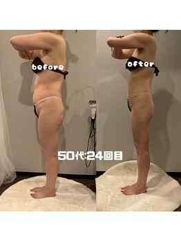 ソウソウビューティー 五反田(Shou Shou Beauty)/ビフォー★アフター　24回目