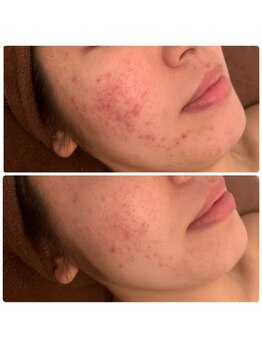 ジョルジオ東京/2Bバイオビューティー