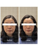 蒼月(aotsuki)/Before/After