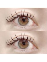 施術後すぐ洗顔OK