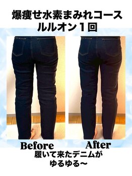 ヨサパーク ココロ 町田店(YOSA PARK COCORO)/BeforeAfter