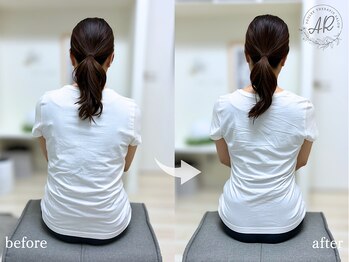 エーアール(AR)/【Before/After】