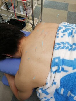 東陽町駅前たけだ整骨院 鍼灸院 整体院/肩こり