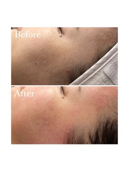 ホワイトワックス 京都四条烏丸(WHITE WAX)/ワックスでくすみOFF