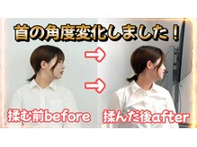 リバイタライズ リート(revitalize RITO)/首の角度