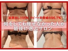 ハナチュチュ 矢場町店(Hanachuchu)