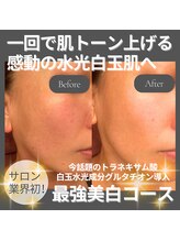 ラ ミュー エステハウス 松阪店/最強美白コース！水光白玉肌