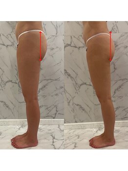 Beauty Salon Leyra【バストアップ/痩身/小顔/筋膜リリース】【4/22 NEWOPEN(予定)】/