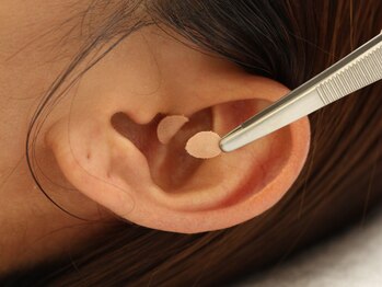 整体アンドリラクゼーション ステラ/施術（耳反射区）