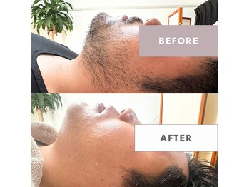 レアメル(reamel)