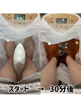 エルプラス(L+)/フッドデトックス 2