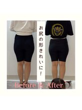 スタイルラボ高松/産後の骨盤矯正の効果♪