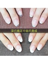 マニエネイル(mani e nail)/深爪矯正で自爪育成の途中経過