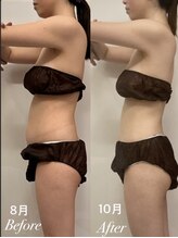 ボディヒーリングアンド小顔美容矯正 プララン/お客様ビフォーアフター★