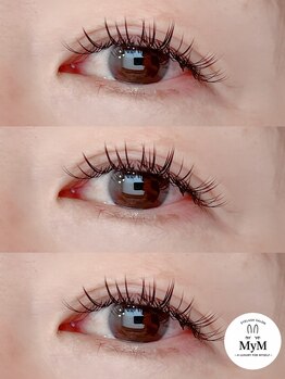 マイム(MyM)/施術例