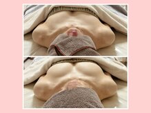 イッツソウ(It's so...)/ビフォーアフター写真