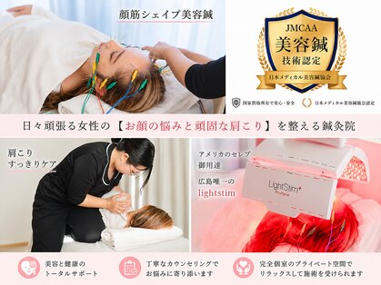 アキュエ(ACUE)の写真