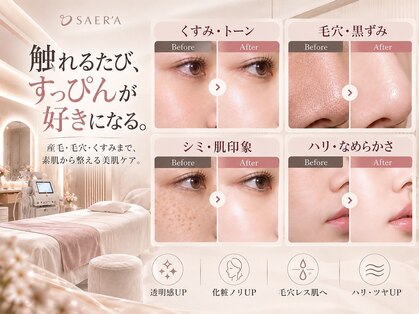 サエラ(SAERA)の写真