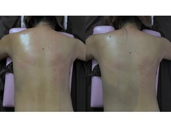 ココア(CoCoa)/活性リンパ洗浄