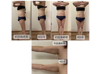 リア(Lia)/ビフォーアフター画像