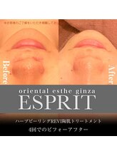 エスプリ 銀座店/ハーブピーリング銀座