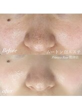 プリンセスローズ 焼津店(Princess Rose)/ムートン泡エステ