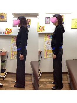 ヒデ整体院(Hide整体院)/猫背矯正骨盤矯正B/A肩こり腰痛