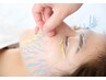 【即効×劇的変化】◇100本の鍼で圧倒的効果◎ 小顔矯正、パック付き