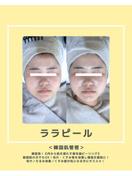 ソワナ(soina)/【神楽坂駅/フェイシャル/毛穴】