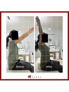 ナオル整体 北千住院(NAORU整体)/肩の痛み改善