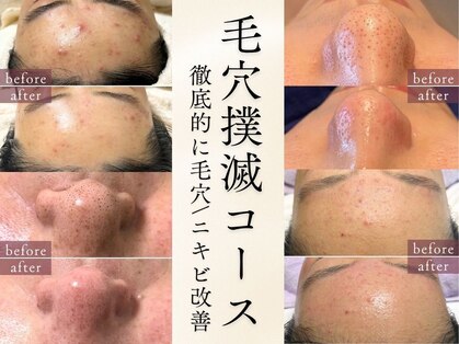 ビシア(Bicia)の写真