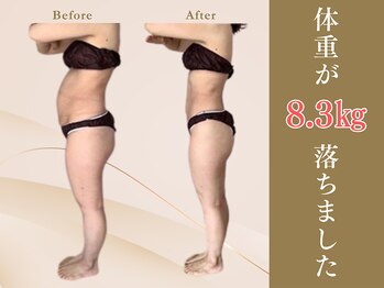 よのひ整体院/40代女性　3ヵ月コース