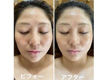 ナオフクオカ ヒーリングフォースエヌ(NaoFukuoka/healingforceN)の雰囲気（ヒト幹細胞化粧品「esther」九州初の正規代理店です。）