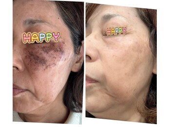 東洋経絡エステ アンド リラクゼーション/沖縄発シミケア