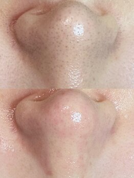 グリーン(green)/メイク悩み改善!