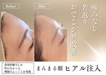エクラヴィ(Eclatvie)