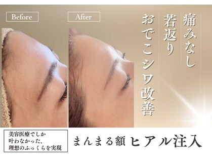 エクラヴィ(Eclatvie)の写真