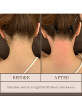 ルディ 阿波座店(rudi)/うなじ ワックス＆光脱毛