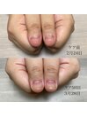 自爪育成コース