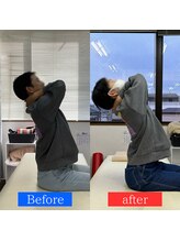 ナオル整体 神戸住吉院(NAORU整体)/20代男性　【綺麗な姿勢へ】