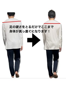 整体ハロ(整体HALO)/歩行中の身体の傾きも解消！