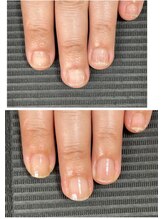 ルカロンネイル(Rukaron Nail)/2枚爪